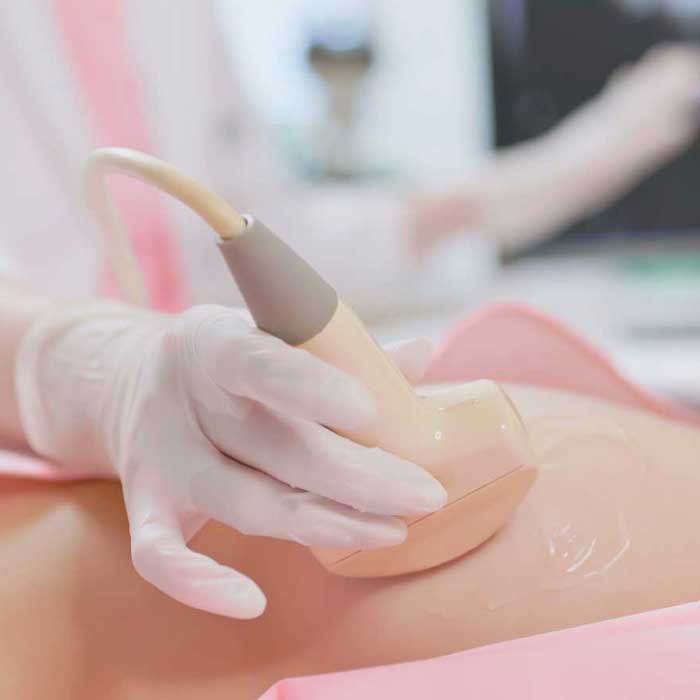 Ultraschalluntersuchung der weiblichen Brust